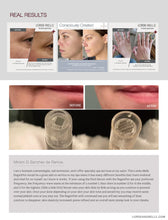 Load image into Gallery viewer, LORDE + BELLE : RegenPen™️