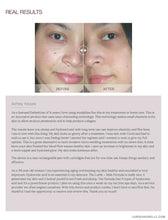 Load image into Gallery viewer, LORDE + BELLE : RegenPen™️