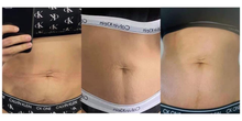 Load image into Gallery viewer, ageLOC® Galvanic® Body Spa Package